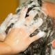 Dermatitis seborreica tratamiento